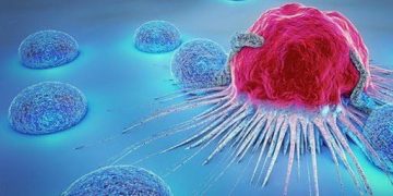 4 Dấu Hiệu Cảnh Báo Ung Thư Vào Buổi Sáng