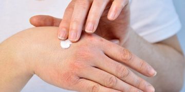 6 Cách Khắc Phục Da Khô Ngứa Trong Mùa Đông